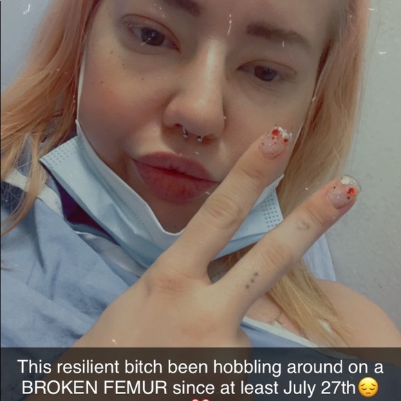 Iss me - Picture 8 of 12